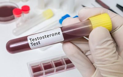 Testosterone and Men’s Health